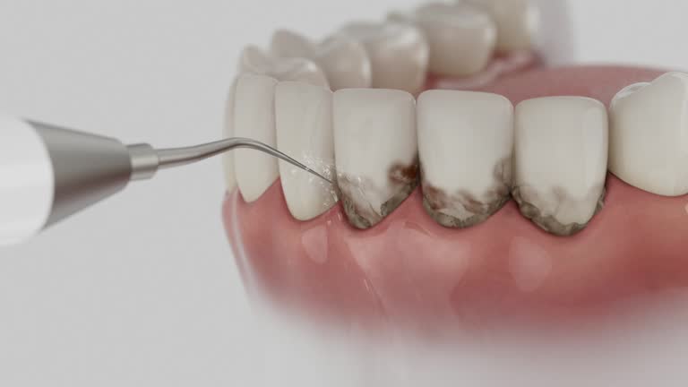 Reliable Dental Implants contractor in Blackhawk, SD by Smile Center Dentistry